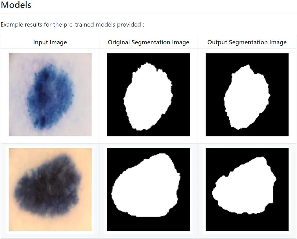 Skin Lesion Segmentation with Improved U-Net
